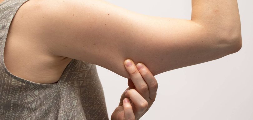 body dysmorphia|