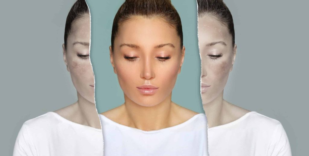 Debunking 3 Myths About Schizophrenia Symptoms